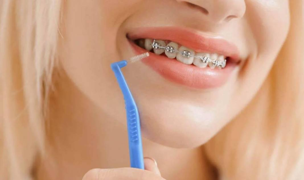 Dişinizi Fırçalarken Yaptığınız Hataları Biliyor musunuz? - Resim: 23